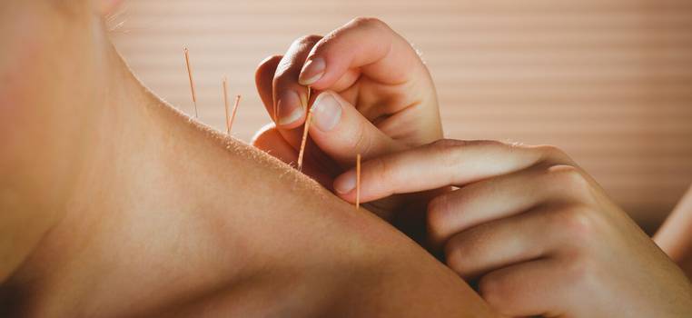  Akupunktura: jak funguje a k čemu se používá
