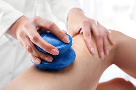  Vacuotherapy: suction treatment on the skin helps fight cellulite